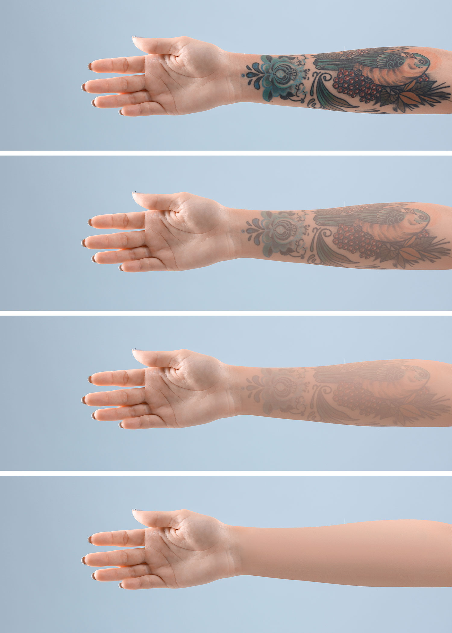 Know about the different methods of Tattoo Removal.