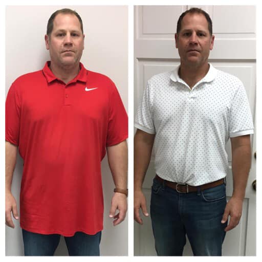 before-after-revivify-lean-clinic-Beaumont-Texas-Ronnie