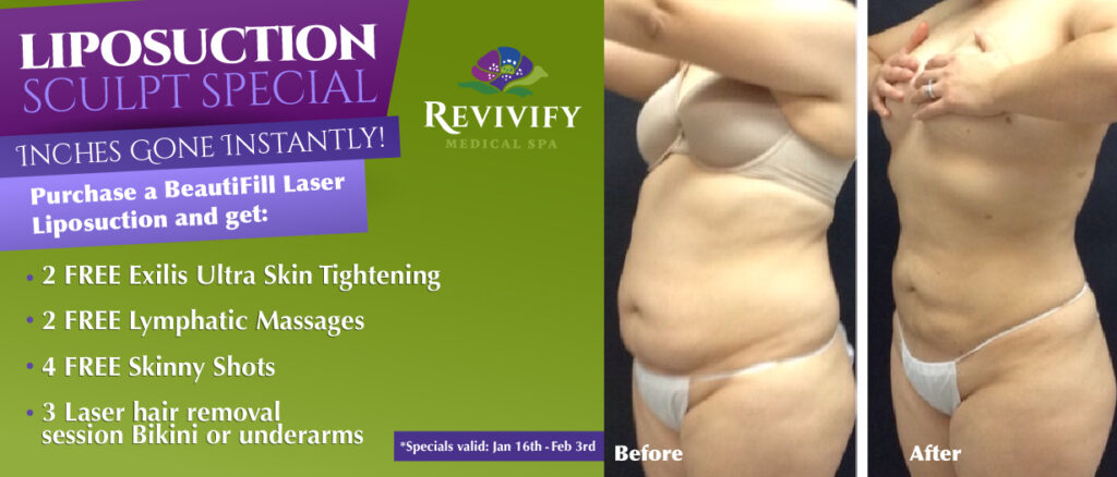 BeautiFill Liposuction Sculpt Special